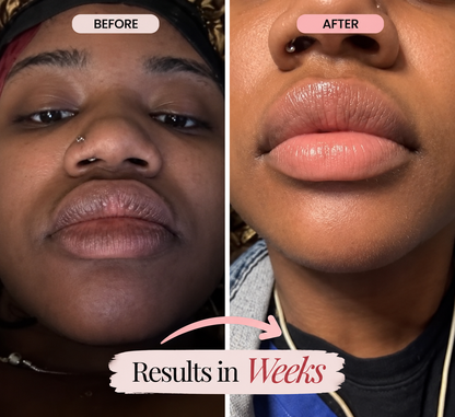 RiLO™ Dark Lip Brightening Cream