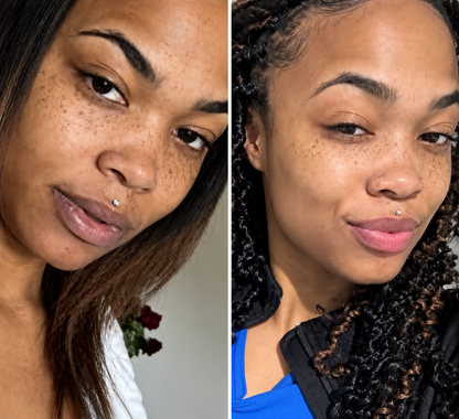 RiLO™ Dark Lip Brightening Cream